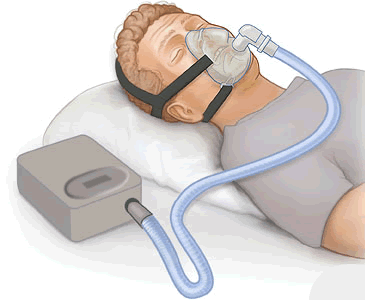 The Benefits of Using Full Face CPAP Masks: How it Can Improve Your Sleep